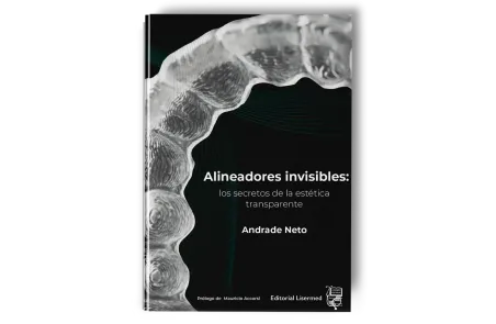 Alineadores Invisibles: Los Secretos de la Estética Transparente. Andrade Nieto - Lisermed