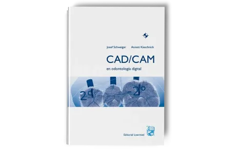 CAD-CAM en Odontología Digital. Josef Schweiger / Annett Kieschnick. Lisermed