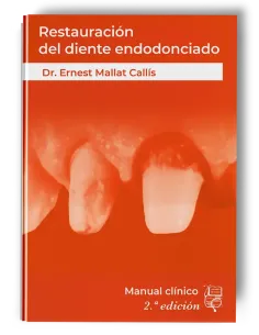 Restauración del Diente Endodonciado Manual Clínico. Ernest Mallat -Lisermed