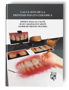 Las Claves de la Prótesis Fija en Cerámica - Ernest Mallat Callís / Juan Cadafalch Cabaní / Javier de Miguel Figuero - Lisermed