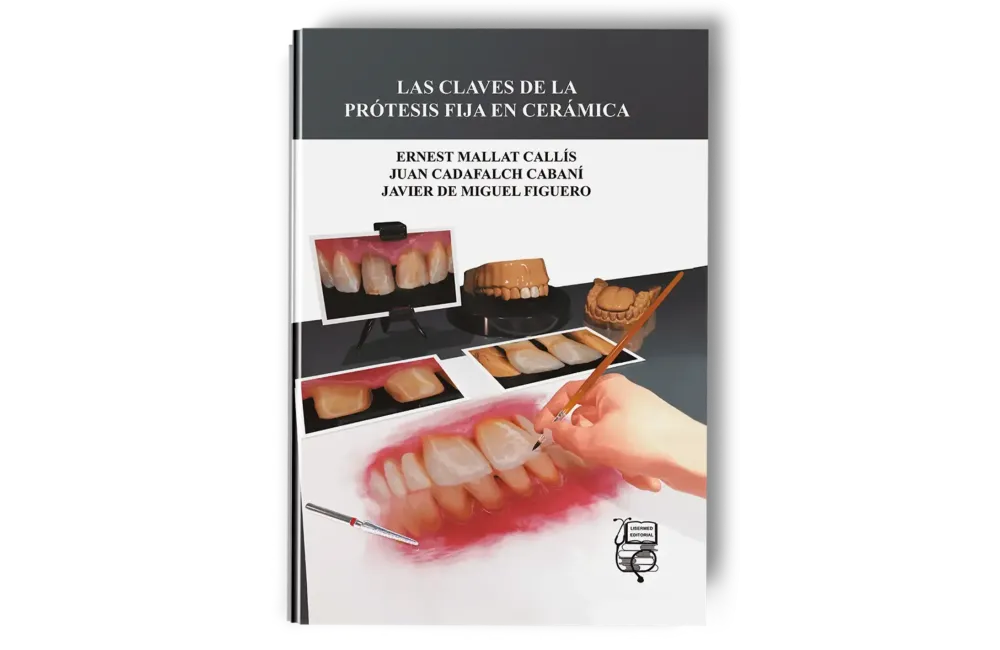 Las Claves de la Prótesis Fija en Cerámica - Ernest Mallat Callís / Juan Cadafalch Cabaní / Javier de Miguel Figuero - Lisermed