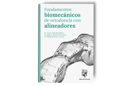 Fundamentos biomecánicos de ortodoncia con alineadores