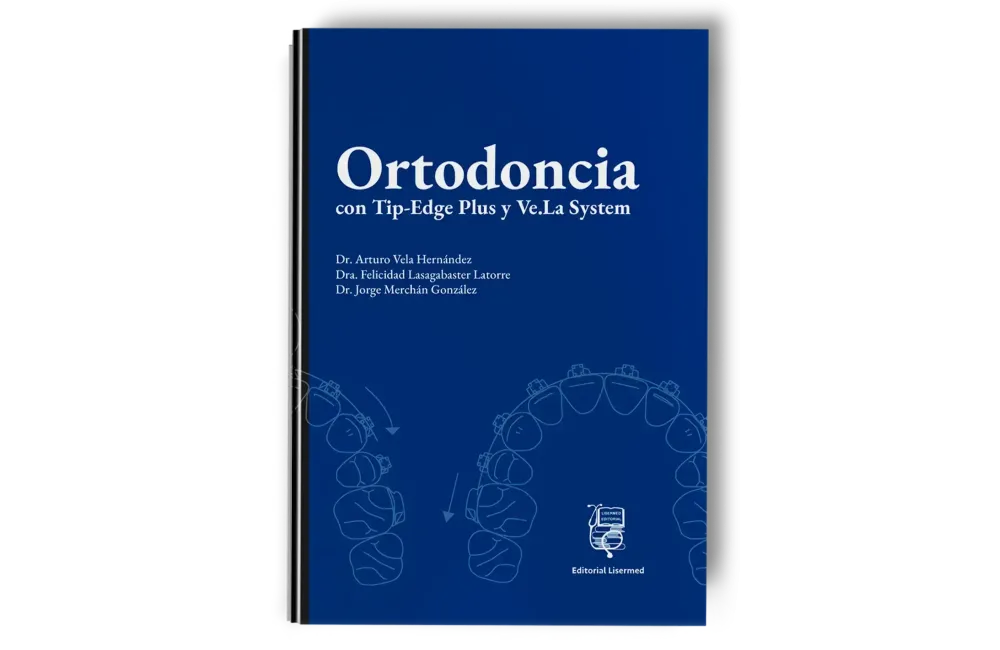 Ortodoncia con Tip-Edge Plus y Ve.La System - Arturo Vela - Lisermed