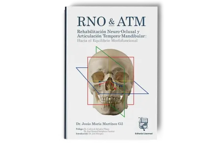 RNO & ATM Rehabilitación Neuro-Oclusal y Articulación Temporo-Mandibular: Hacia el Equilibrio Morfofuncional