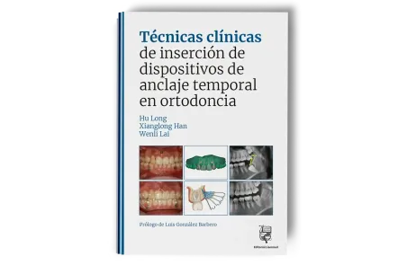 Técnicas clínicas de dispositivos de anclaje temporal en ortodoncia