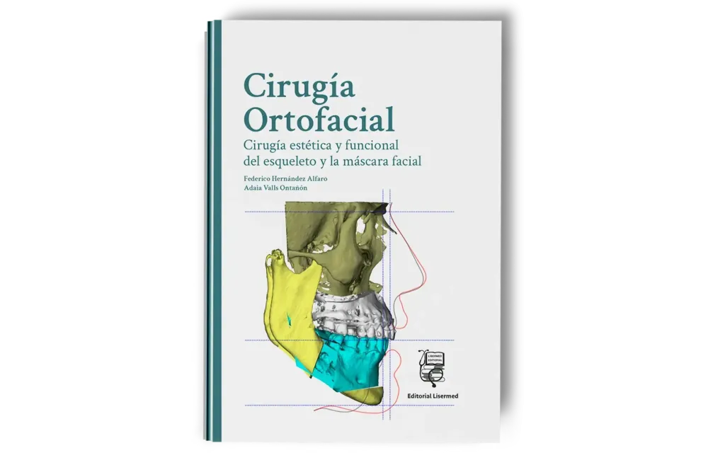 Cirugía Ortofacial. Cirugía estética y funcional del esqueleto y la máscara facial