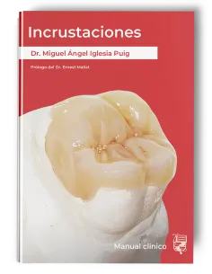 Incrustaciones - Manual clínico