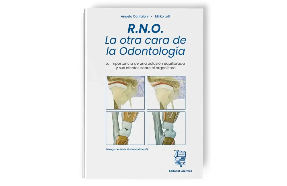 RNO. La otra cara de la Odontología - Lisermed