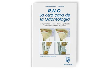 RNO. La otra cara de la Odontología - Lisermed