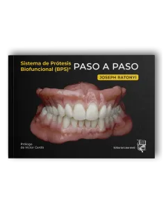 Sistema de Prótesis Biofuncional (BPS)® Paso a Paso