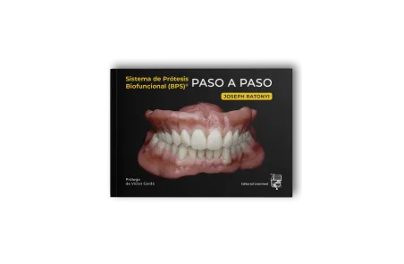 Sistema de Prótesis Biofuncional (BPS)® Paso a Paso