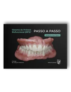 Sistema de Prótese Biofuncional (BPS)® Passo a Passo – Português