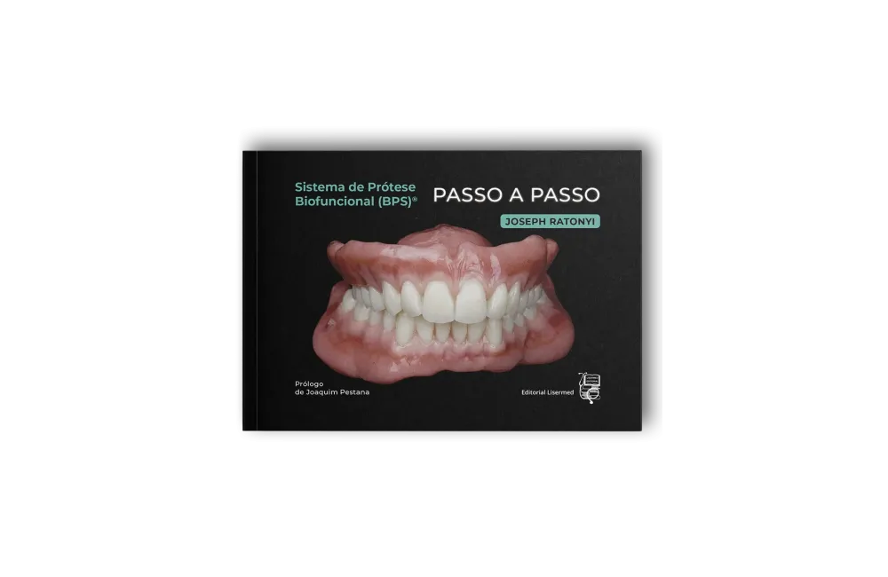 Sistema de Prótese Biofuncional (BPS)® Passo a Passo – Português