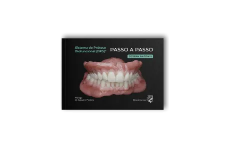 Sistema de Prótese Biofuncional (BPS)® Passo a Passo – Português