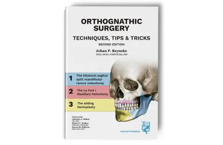 Orthognathic Surgery. Techniques, tips & tricks.
