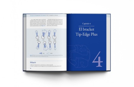 Ortodoncia con Tip-Edge Plus y Ve.La System