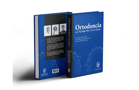 Ortodoncia con Tip-Edge Plus y Ve.La System