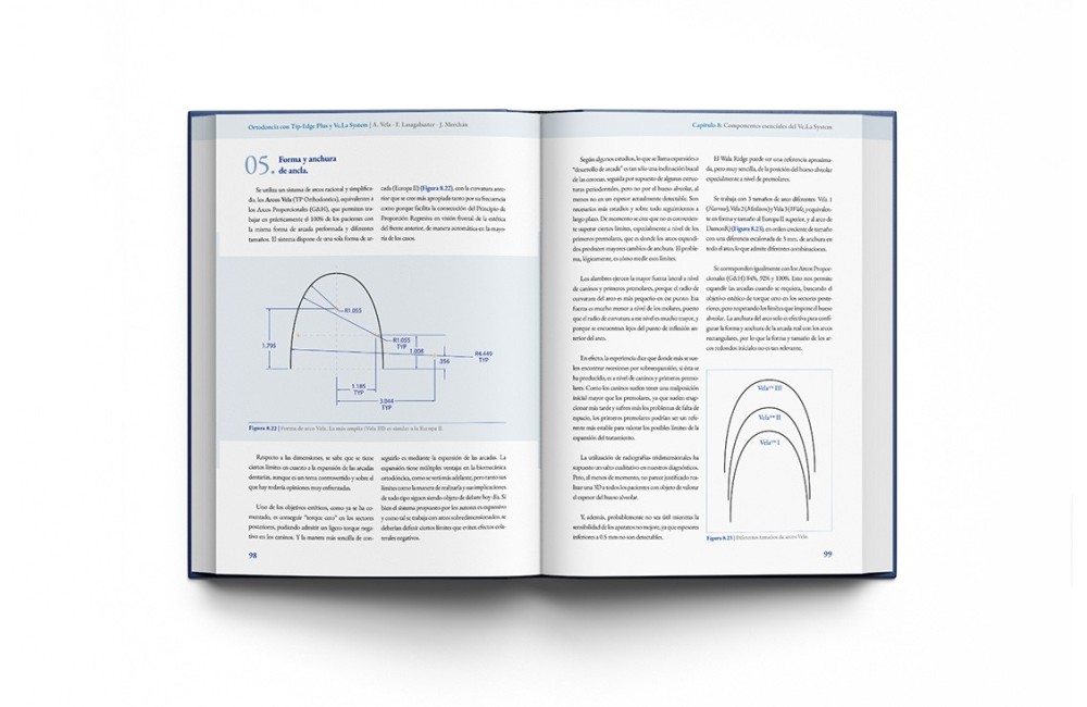 Ortodoncia con Tip-Edge Plus y Ve.La System