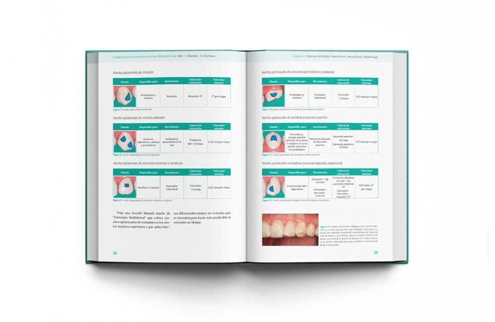 Fundamentos biomecánicos de ortodoncia con...