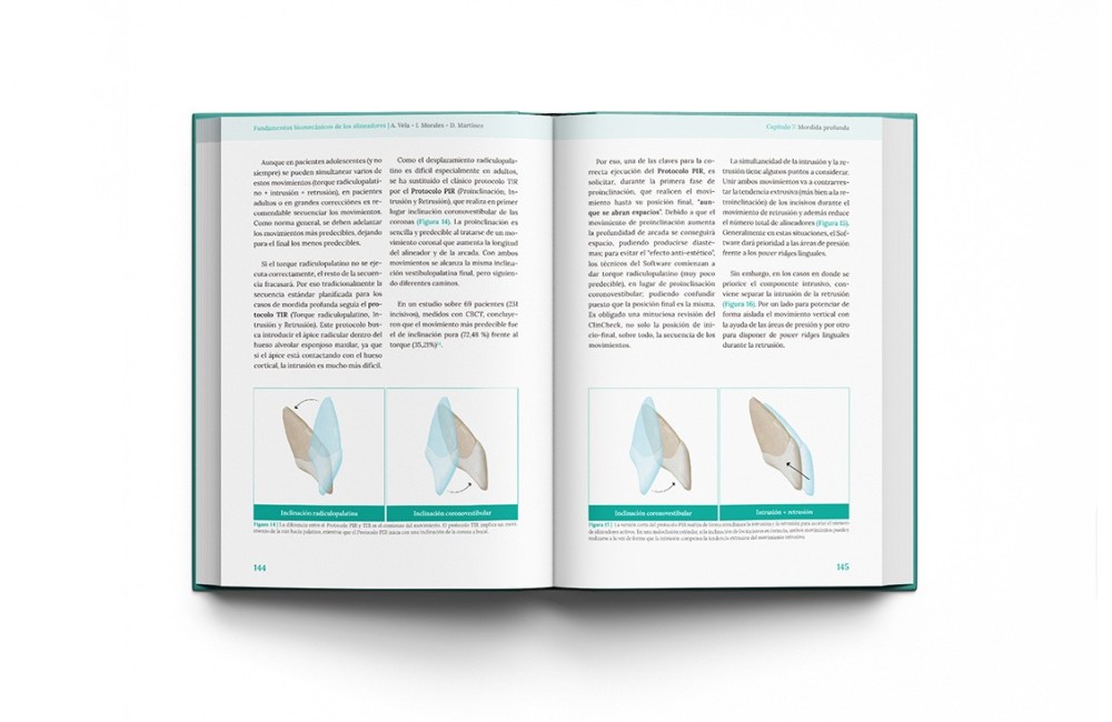 Fundamentos biomecánicos de ortodoncia con...