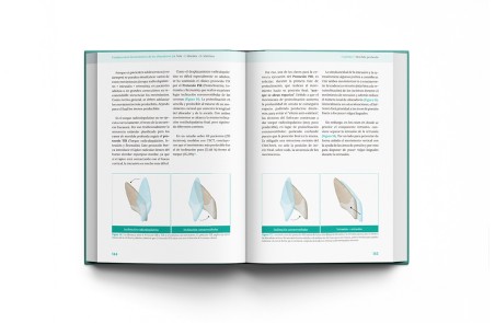Fundamentos biomecánicos de ortodoncia con alineadores