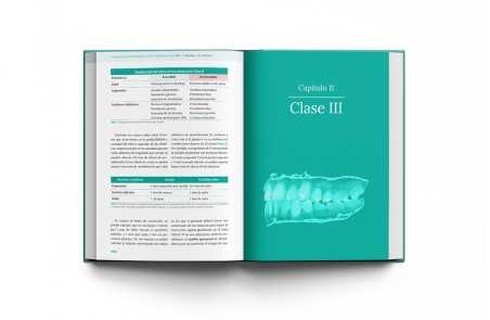 Fundamentos biomecánicos de ortodoncia con alineadores