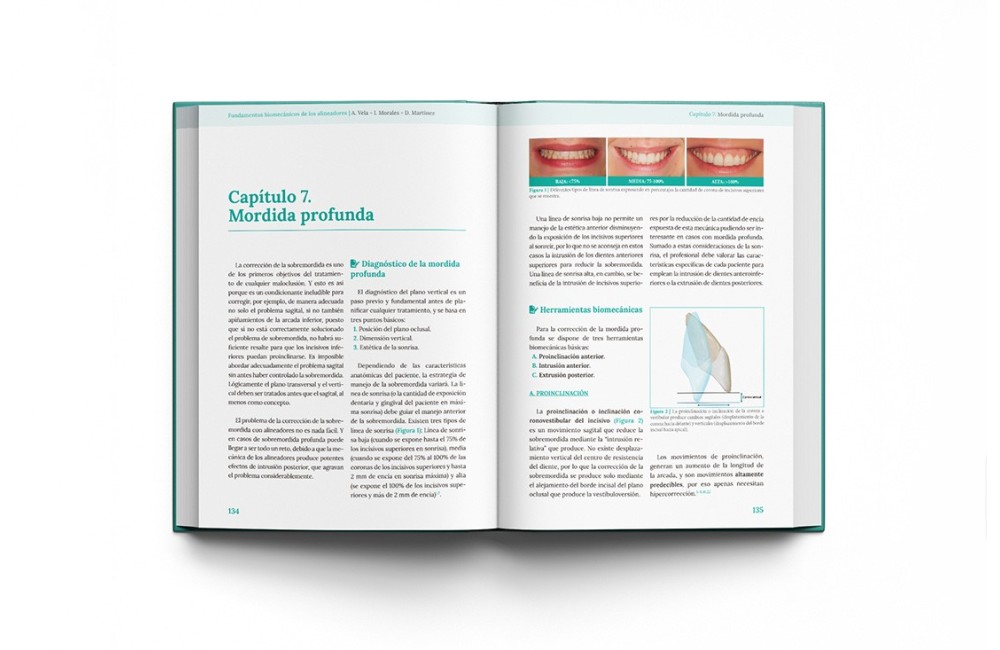 Fundamentos biomecánicos de ortodoncia con...