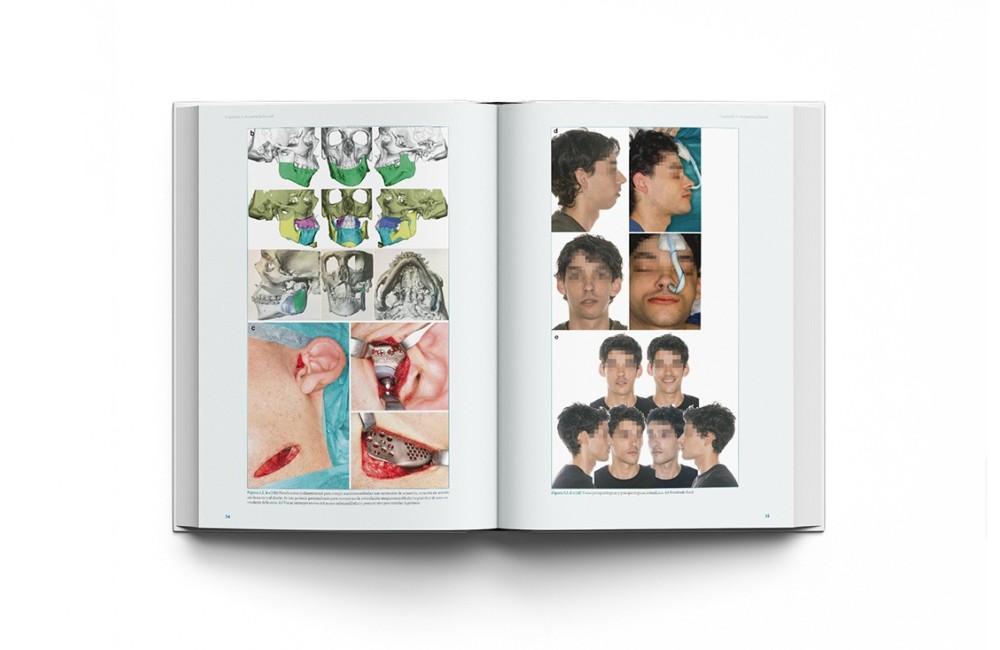 Cirugía Ortofacial. Cirugía estética y...