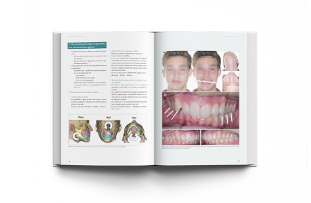 Cirugía Ortofacial. Cirugía estética y funcional del esqueleto y la máscara facial