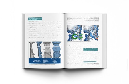 Cirugía Ortofacial. Cirugía estética y funcional del esqueleto y la máscara facial