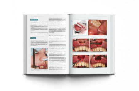 Cirugía Ortofacial. Cirugía estética y funcional del esqueleto y la máscara facial