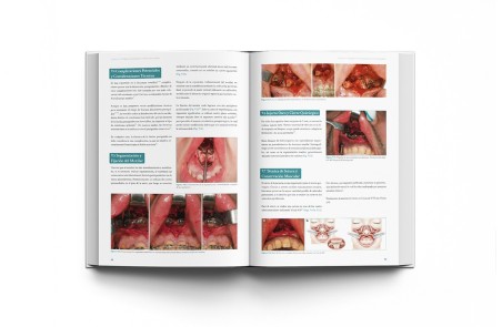 Cirugía Ortofacial. Cirugía estética y funcional del esqueleto y la máscara facial