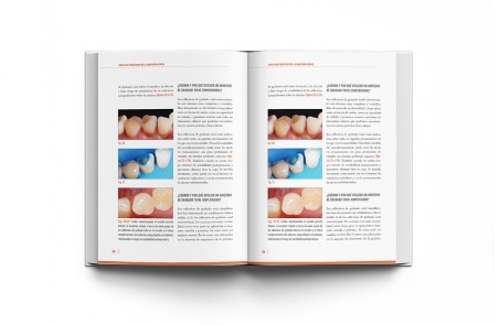 Adhesión Dental Manual Clínico
