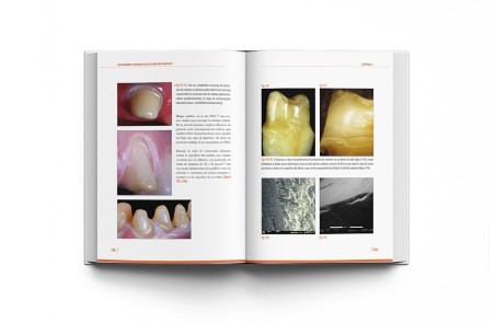 Adhesión Dental Manual Clínico