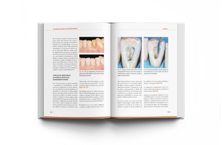 Adhesión Dental Manual Clínico