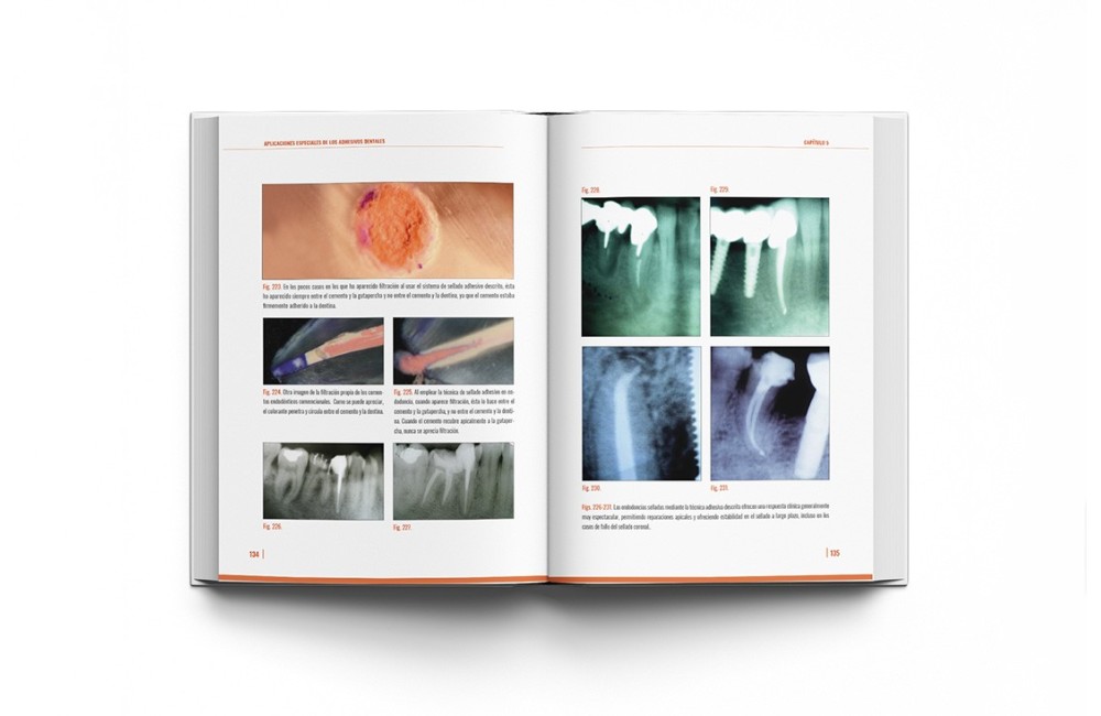 Adhesión Dental Manual Clínico