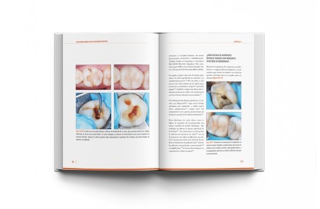 Adhesión Dental Manual Clínico