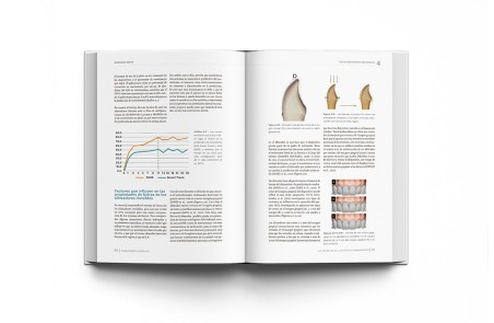 Alineadores Invisibles: Los Secretos de la Estética Transparente