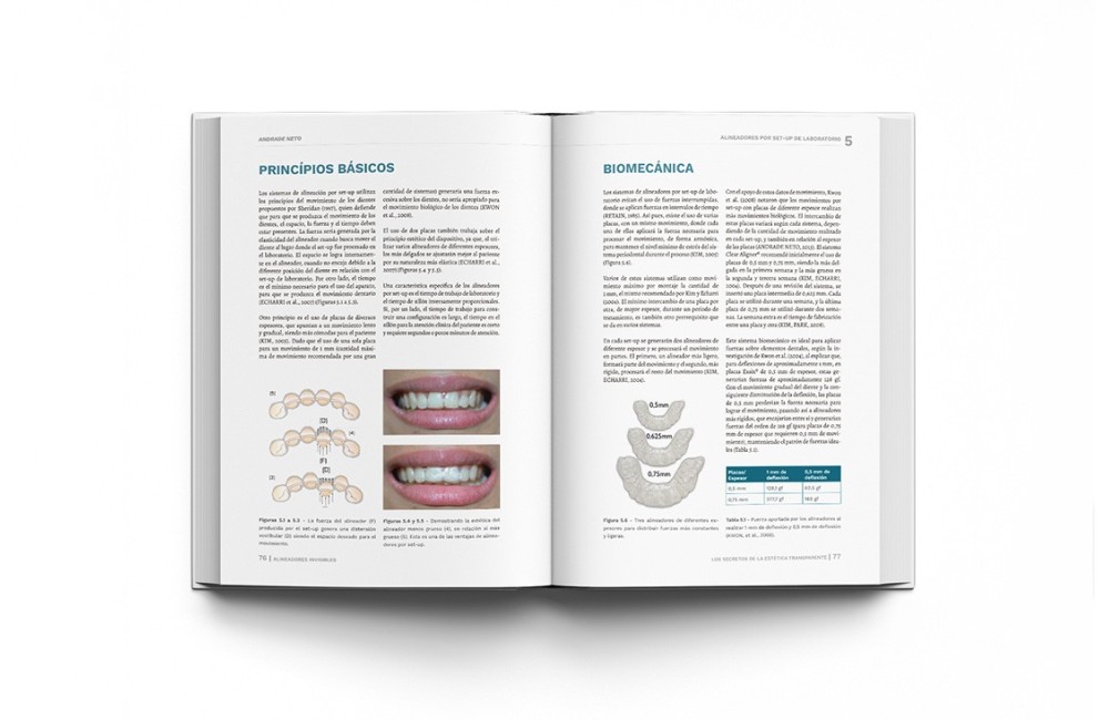 Alineadores Invisibles: Los Secretos de la...