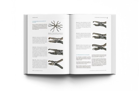 Alineadores Invisibles: Los Secretos de la Estética Transparente