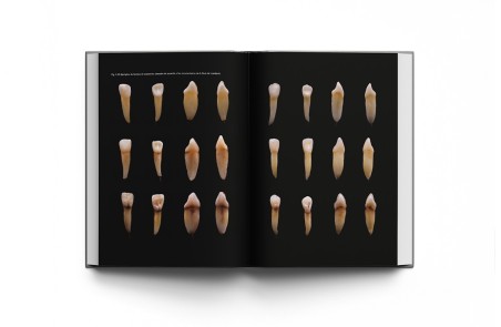 El Arte de Hacer Dientes