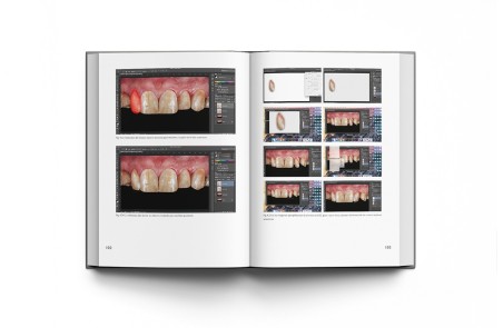 El Arte de Hacer Dientes