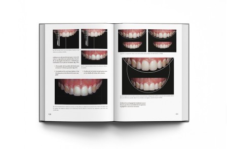 El Arte de Hacer Dientes