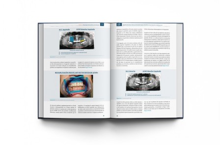 RNO & ATM Rehabilitación Neuro-Oclusal y Articulación Temporo-Mandibular: Hacia el Equilibrio Morfofuncional