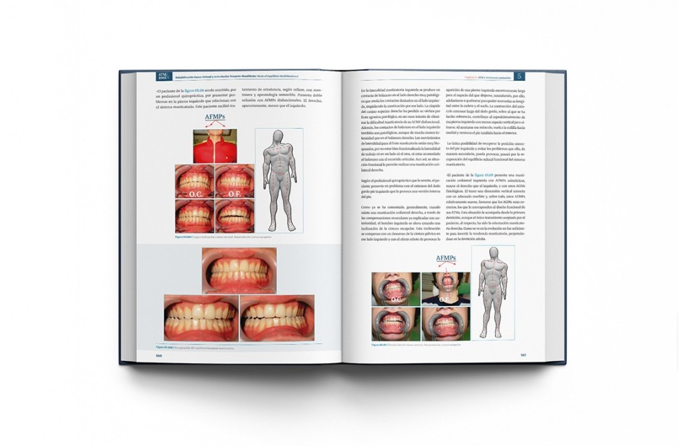 RNO & ATM Rehabilitación Neuro-Oclusal y...