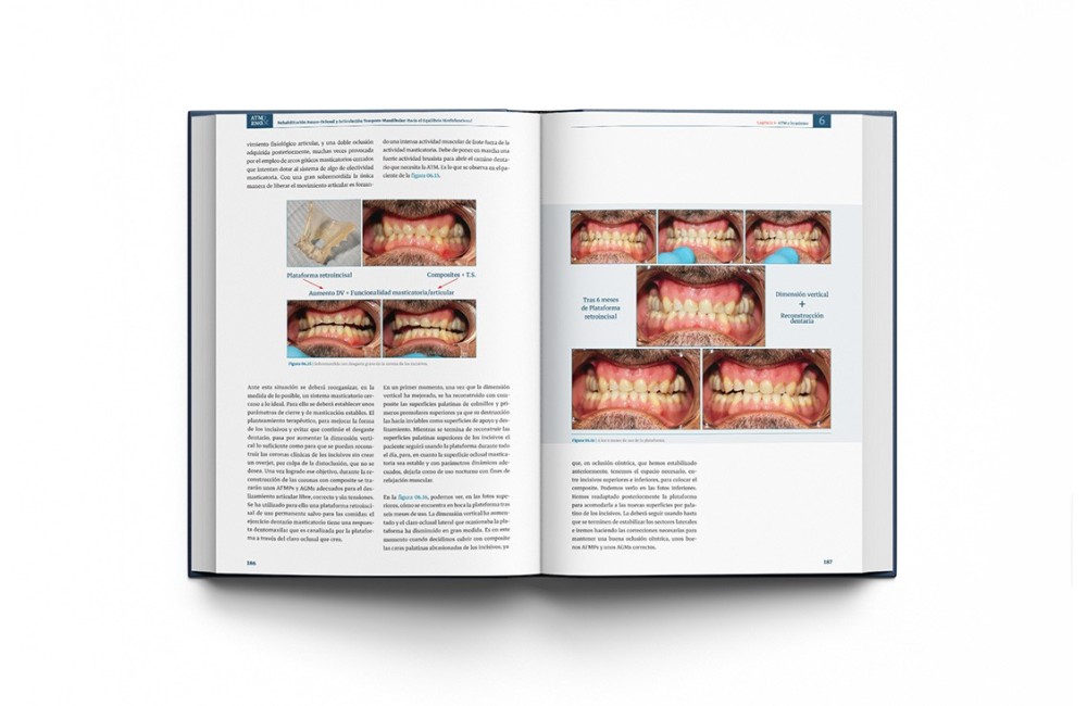 RNO & ATM Rehabilitación Neuro-Oclusal y...