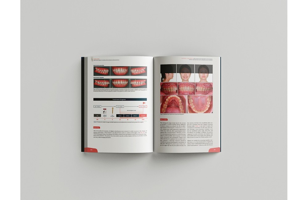 Miniscrew applications in orthodontics