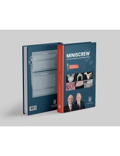 Miniscrew applications in orthodontics 2