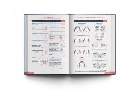 Minitornillos. Aplicaciones clínicas en ortodoncia