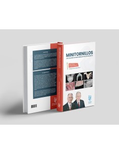 Minitornillos. Aplicaciones clínicas en ortodoncia 2